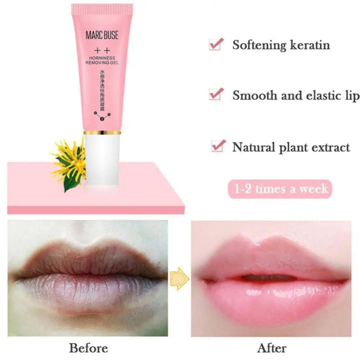 2 Pieces Lip Care Set Gel and Mask - Mishastyle