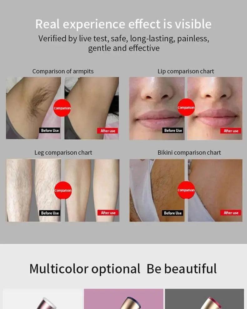 999999 Flash Laser Permanent Hair Removal - Mishastyle